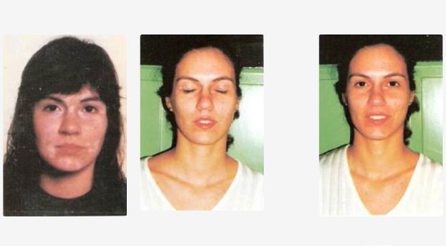 Caso 1