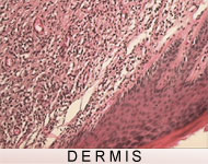 Dermis