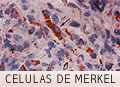Células de Merkel